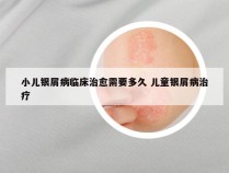 小儿银屑病临床治愈需要多久 儿童银屑病治疗