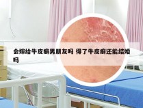 会嫁给牛皮癣男朋友吗 得了牛皮癣还能结婚吗