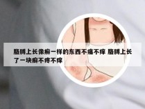 胳膊上长像癣一样的东西不痛不痒 胳膊上长了一块癣不疼不痒