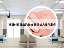 潮湿对银屑病的影响 银屑病人湿气重吗