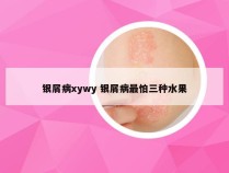 银屑病xywy 银屑病最怕三种水果