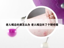 老人嘴边长癣怎么办 老人嘴边长了个硬疙瘩