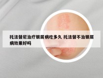 托法替尼治疗银屑病吃多久 托法替不治银屑病效果好吗