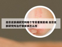 南京皮肤病研究所哪个专家看银屑病 南京皮肤研究所治疗银屑病怎么样