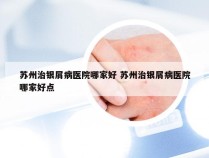 苏州治银屑病医院哪家好 苏州治银屑病医院哪家好点
