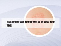 点滴状银屑病用本维莫德乳膏 银屑病 本维莫德