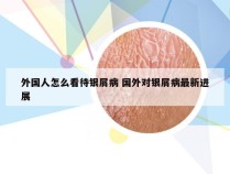 外国人怎么看待银屑病 国外对银屑病最新进展