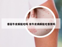 香菇牛皮癣能吃吗 有牛皮病癣能吃香菜吗