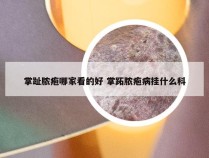 掌趾脓疱哪家看的好 掌跖脓疱病挂什么科