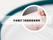 牛皮癣打了新冠疫苗有事吗