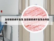 急性银屑病不复发 急性银屑病不复发会传染吗