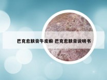 巴克愈肤膏牛皮癣 巴克愈肤膏说明书