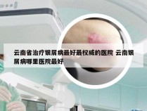云南省治疗银屑病最好最权威的医院 云南银屑病哪里医院最好