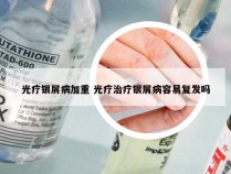 光疗银屑病加重 光疗治疗银屑病容易复发吗