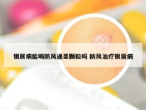 银屑病能喝防风通圣颗粒吗 防风治疗银屑病
