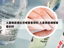 儿童银屑病北京哪里看得好 儿童银屑病哪里看的好