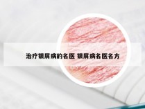 治疗银屑病的名医 银屑病名医名方
