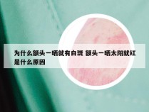为什么额头一晒就有白斑 额头一晒太阳就红是什么原因