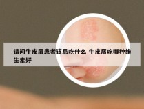 请问牛皮屑患者该忌吃什么 牛皮屑吃哪种维生素好