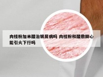 肉桂粉加米醋治银屑病吗 肉桂粉和醋敷脚心能引火下行吗