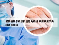 银屑病属于皮肤科还是免疫科 银屑病属于内科还是外科