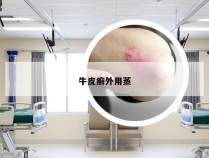 牛皮癣外用蒸
