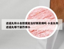 逍遥丸和小金胶囊能治好银屑病吗 小金丸和逍遥丸哪个副作用小