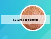 Biocad银屑病 银屑病全部