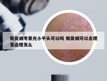银屑病考黑光小平头可以吗 银屑病可以去理发店理发么