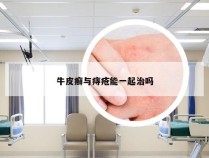 牛皮癣与痔疮能一起治吗