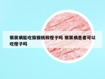 银屑病能吃猕猴桃和橙子吗 银屑病患者可以吃橙子吗