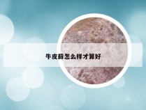 牛皮藓怎么样才算好