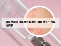 银屑病能吃阿莫西林胶囊吗 银屑病可不可以吃阿胶
