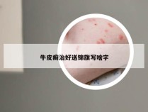 牛皮癣治好送锦旗写啥字