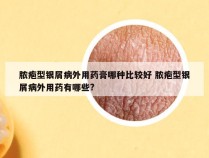 脓疱型银屑病外用药膏哪种比较好 脓疱型银屑病外用药有哪些?