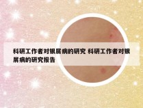科研工作者对银屑病的研究 科研工作者对银屑病的研究报告