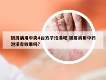 银屑病用中央4台方子泡澡吧 银屑病用中药泡澡有效果吗?
