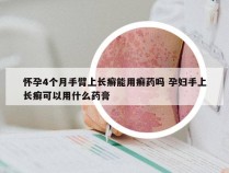怀孕4个月手臂上长癣能用癣药吗 孕妇手上长癣可以用什么药膏
