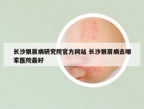 长沙银屑病研究院官方网站 长沙银屑病去哪家医院最好