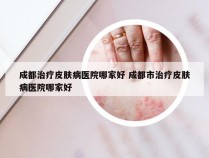 成都治疗皮肤病医院哪家好 成都市治疗皮肤病医院哪家好