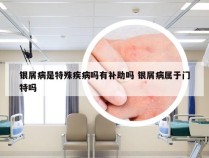 银屑病是特殊疾病吗有补助吗 银屑病属于门特吗