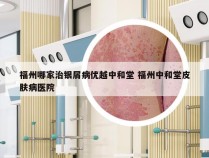 福州哪家治银屑病优越中和堂 福州中和堂皮肤病医院