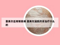 塞美尔适用银屑病 塞美尔凝胶药膏治疗什么的