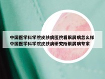 中国医学科学院皮肤病医院看银屑病怎么样 中国医学科学院皮肤病研究所银屑病专家