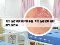 青岛治疗银屑病好的中医 青岛治疗银屑病好的中医大夫