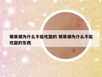 银屑病为什么不能吃甜的 银屑病为什么不能吃甜的东西