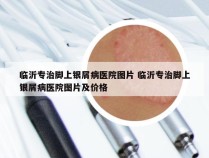 临沂专治脚上银屑病医院图片 临沂专治脚上银屑病医院图片及价格
