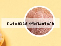 门上牛皮癣怎么去 如何去门上的牛皮广告