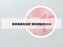 银屑病病友贴吧 银屑病贴吧2020