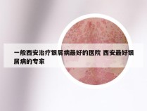 一般西安治疗银屑病最好的医院 西安最好银屑病的专家